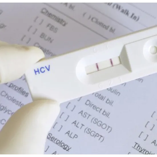 Hepatitis C Antibody